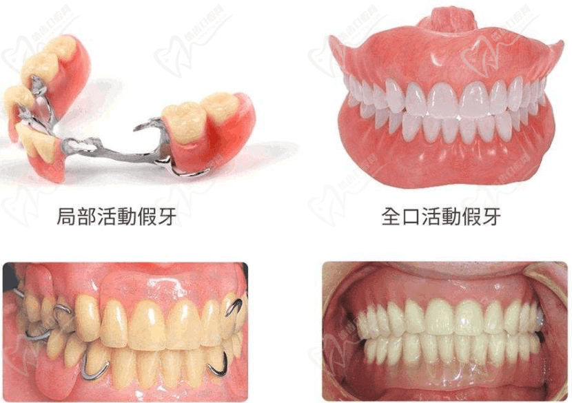 济南丽尔美义齿：匠心雕琢，重拾自信