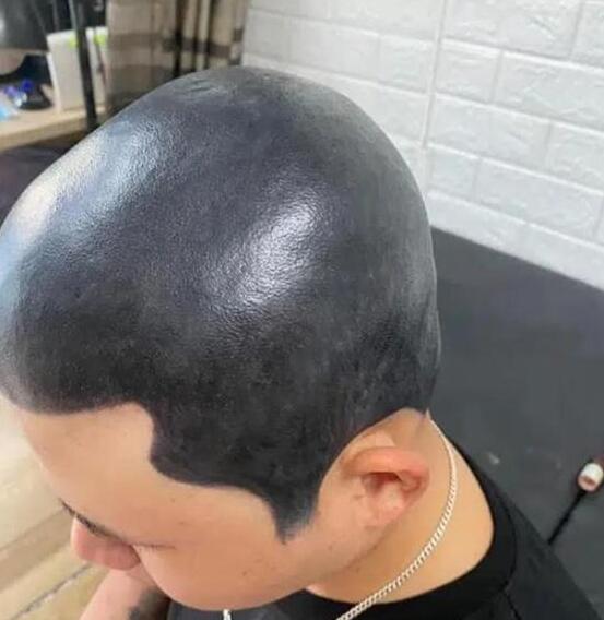 头皮纹身疼吗_纹身头皮疼吗_头上纹身疼吗