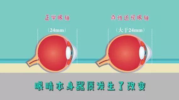对眼睛有益的游戏_手机游戏对眼睛有伤害吗_对眼睛伤害小的手机屏幕