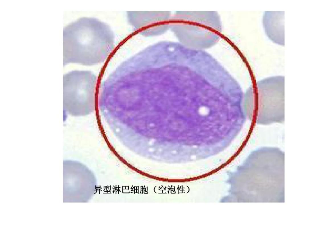寄生虫电影在线看观看投屏_《寄生虫》电影完整版在线观看_电影虫寄生观看在线完整版中文